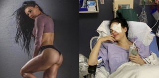 Bikini Olympia winner Ashley Kaltwasser eye surgery
