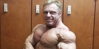 Meadows condition heart attack