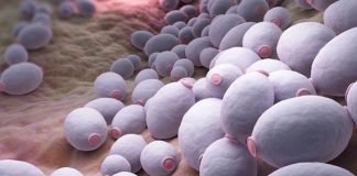 Top 5 Symptoms of Candida 5 Symptoms of Candida