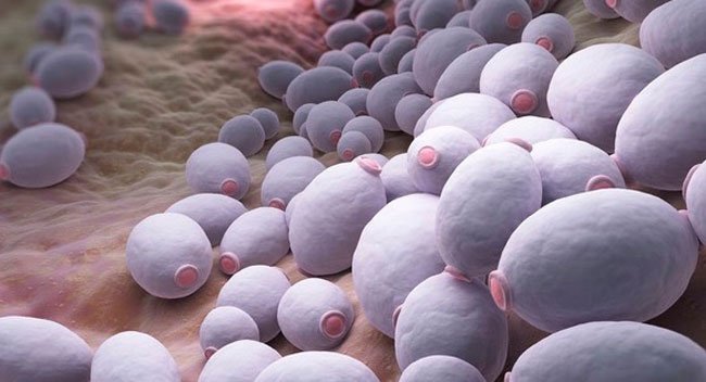 candida-feature 5 Symptoms of Candida