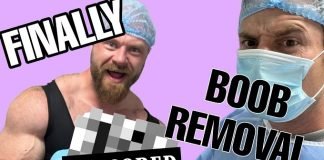 James Hollingshead gyno surgery