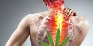 Chronic Pain Prescribed Cannabis