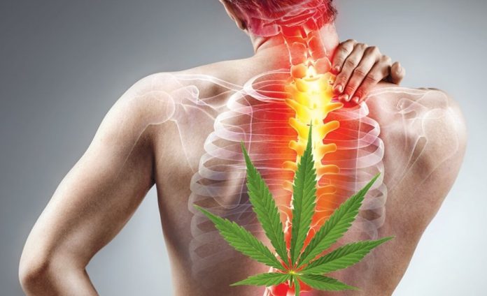 chronic pain canabis Chronic Pain Prescribed Cannabis